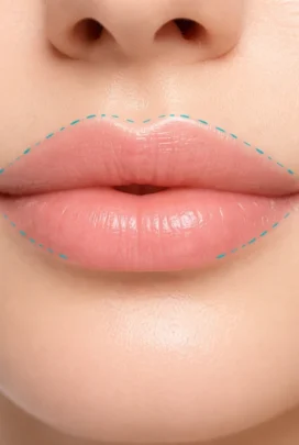 قبل از اقدام (Pre-procedure Care)