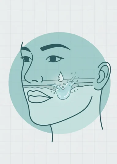 هیالورونیداز در درمان عوارض فیلر